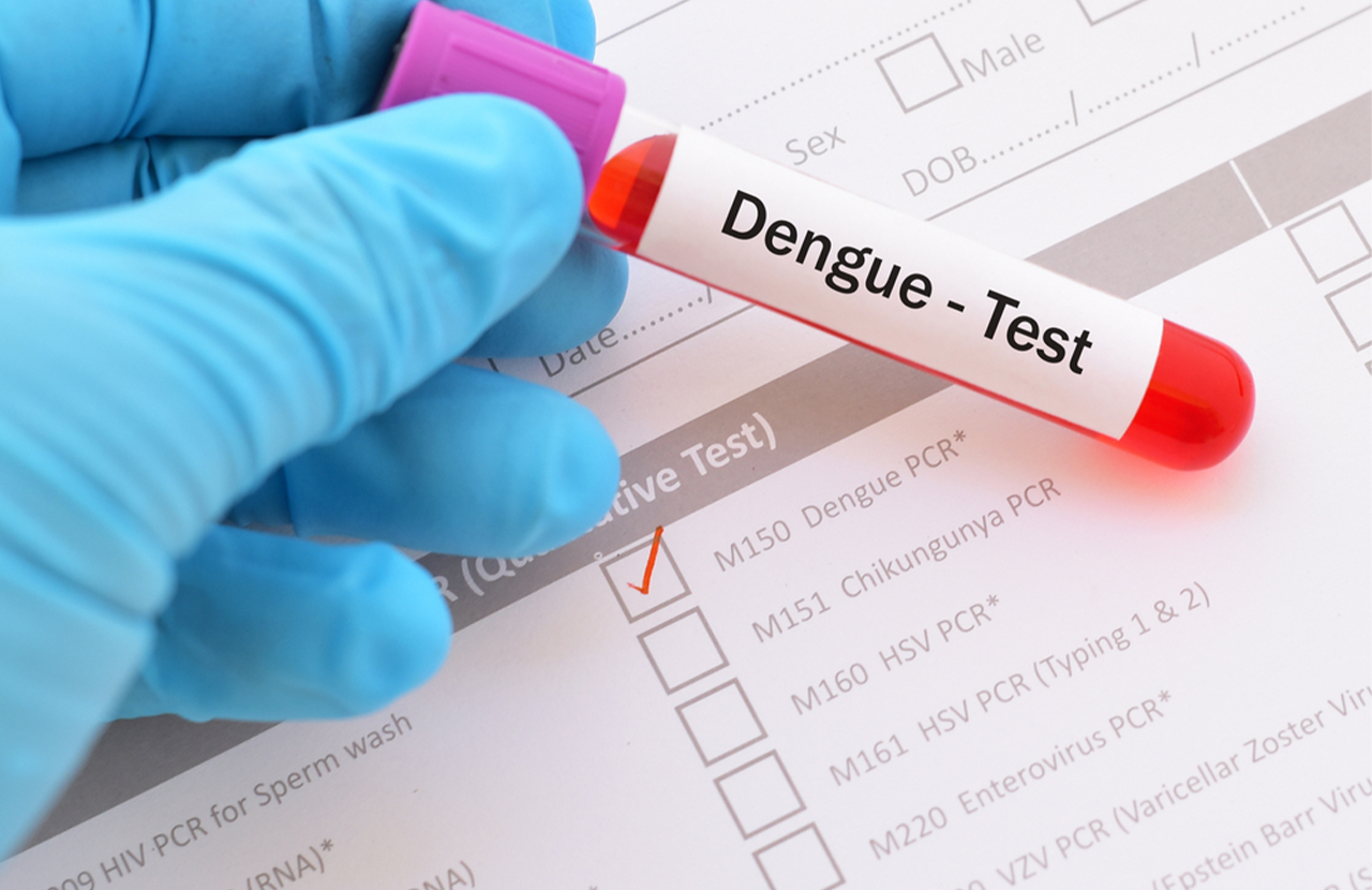 Pemeriksaan NS 1 Ag Dengue dan IgG/IgM Dengue